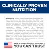Hill’s Science Diet Perfect Digestion, Senior Adult 7+, Digestive Support, Dry Dog Food, Chicken, Brown Rice, & Whole Oats, 22 lb Bag(Chicken  Brown Rice  & Whole Oats)
