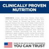 Hill’s Science Diet Sensitive Stomach & Skin, Adult 1-6, Stomach & Skin Sensitivity Support, Dry Dog Food, Grain Free Chicken & Potato, 24 lb Bag